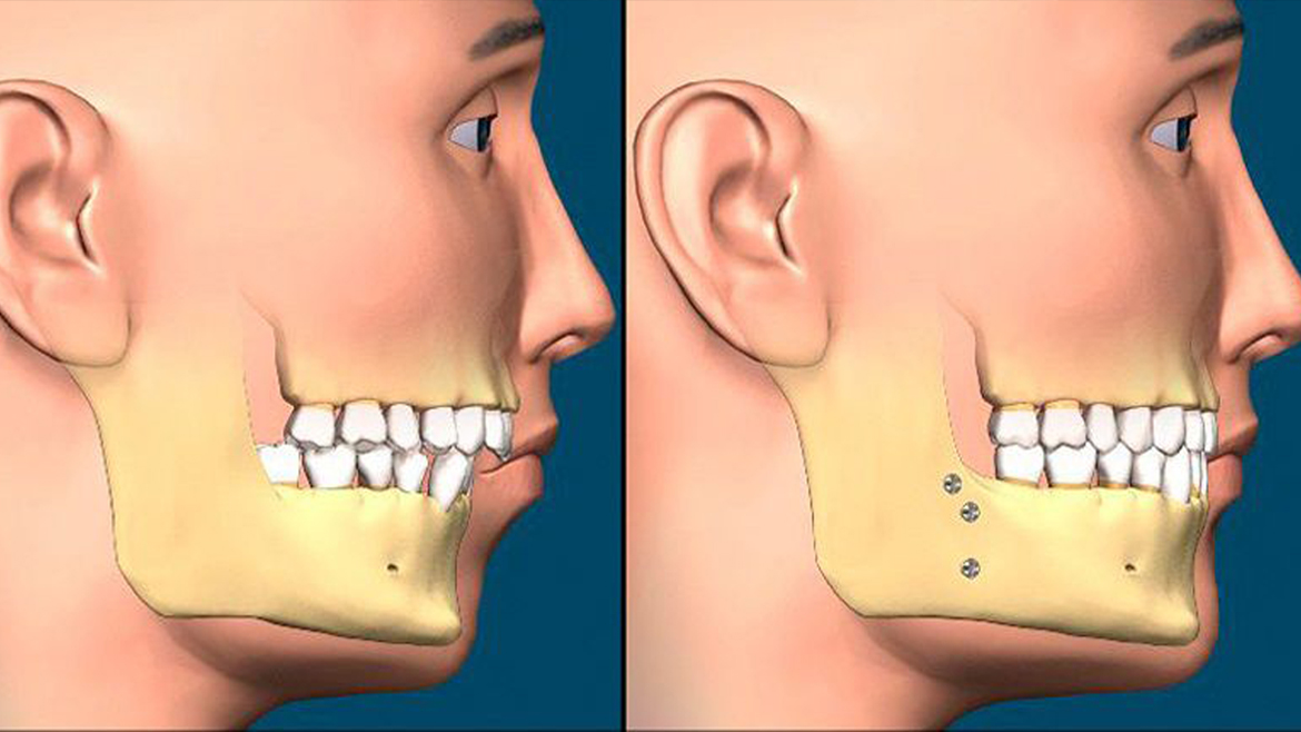 Facio Maxillary